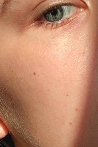 After 8 Weeks
